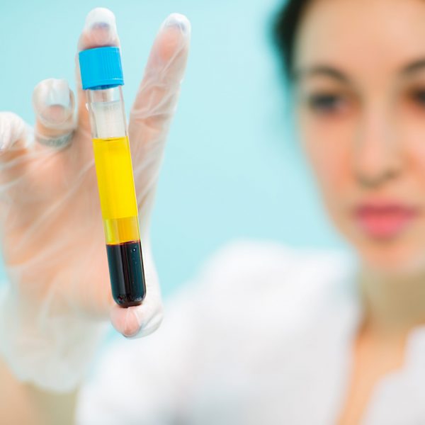 Medical cosmetology blood plasma in vitro keeps the doctor